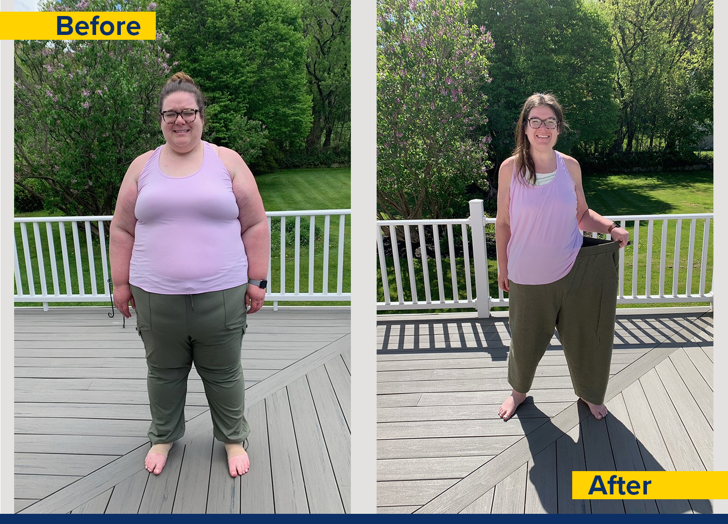 Before and after photos of a woman showing her weight loss journey, highlighting her transformation and confidence.