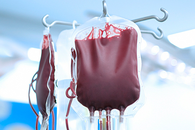 Study Calls Safety of Some Trauma Blood Transfusions into Question
