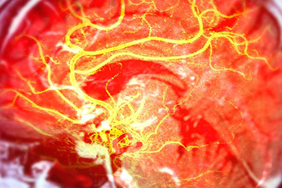 Researchers Harness the Body’s Internal Clock to Improve Stroke Recovery