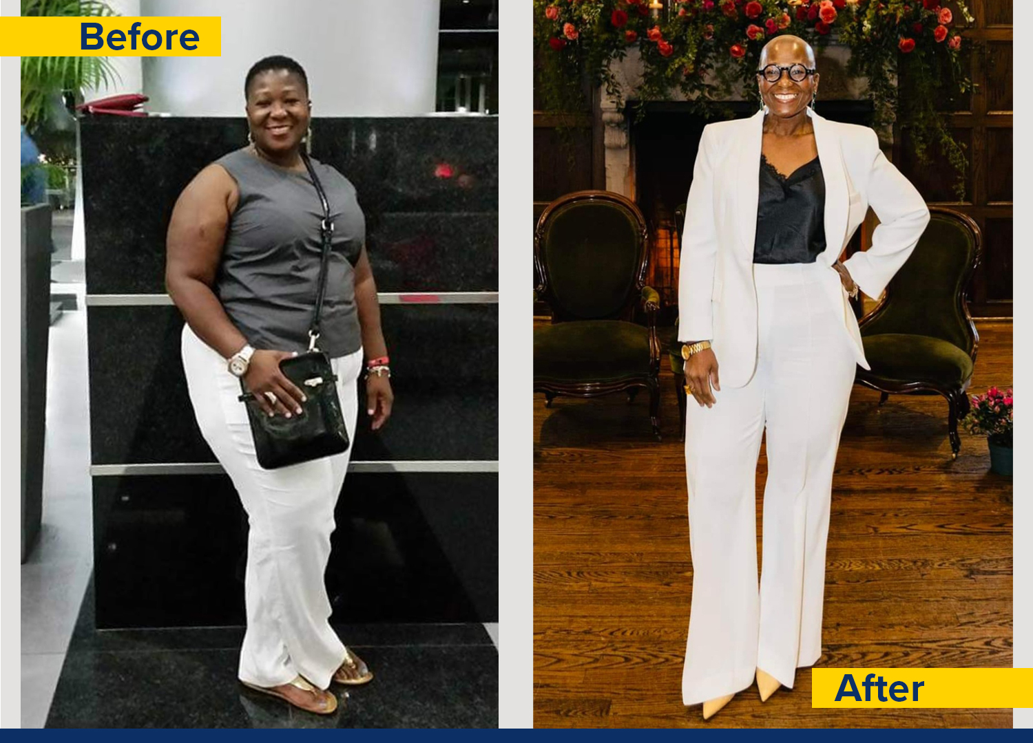 Before and after photos of a women showing significant weight loss, highlighting her a transformation in her look and confidence.