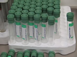 tubes for blood samples