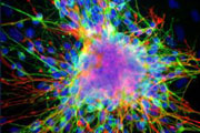 Neurons, oligodendrocytes and astrocytes derived from a single human neural stem cell