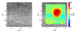 graphs of ultrasound data