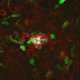 Role of Interleukin-1 in Alzheimer’s Disease Neuropathogenesis