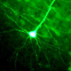 Synaptic Changes During Ocular Dominance Plasticity