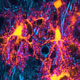 Neuro-glia Interactions