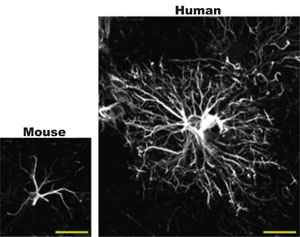 Mouse vs. human astrocytes.