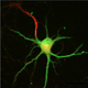 image of spinal motor neuron