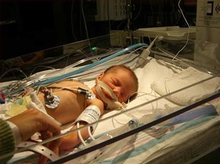 Stella in the hospital as a baby