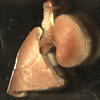Photo of lungs 3