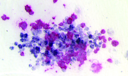 Immunohistochemical staining